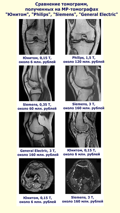 Sravnite prices MRI scanner Sravnite prices MRI scanner