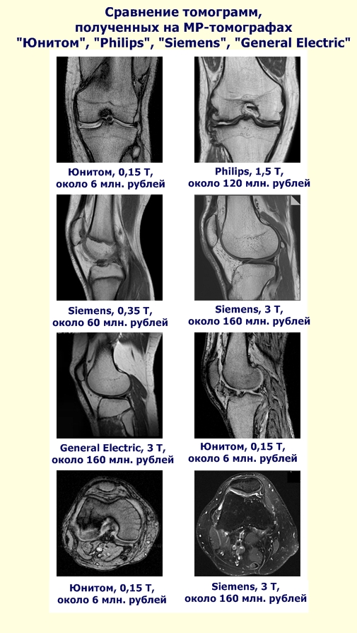 Sravnite prices MRI scanner